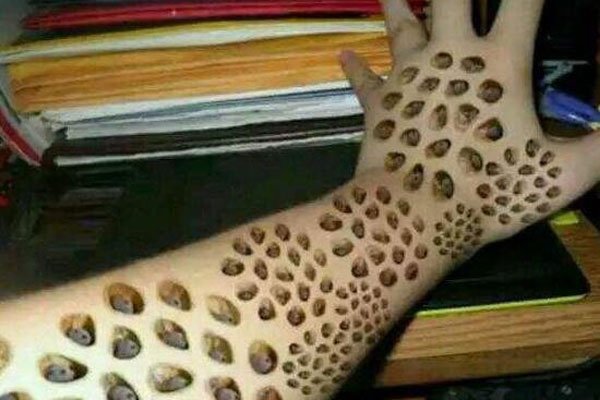 �����к���֥��Ů��ͼƬ�ֲ� �ҵ�ǿ��֢����,��һ�¸���Ū��