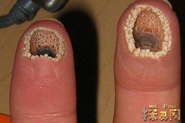 ֥��Ů��ͼƬ�ֲ�ԭͼ ��һ�±�֤����һ����