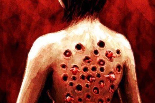 芝麻女孩和玉米男孩怎么了 让我想起了千疮百孔的虫子