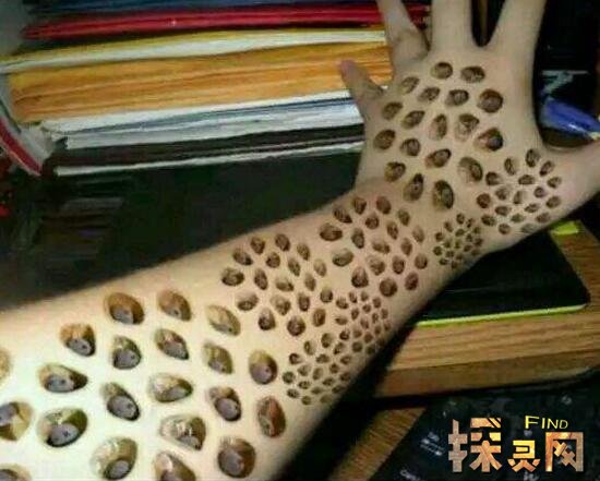 �ܼ��־�֢��������ɶ һ��������鷿�Ĵ���ͼƬ