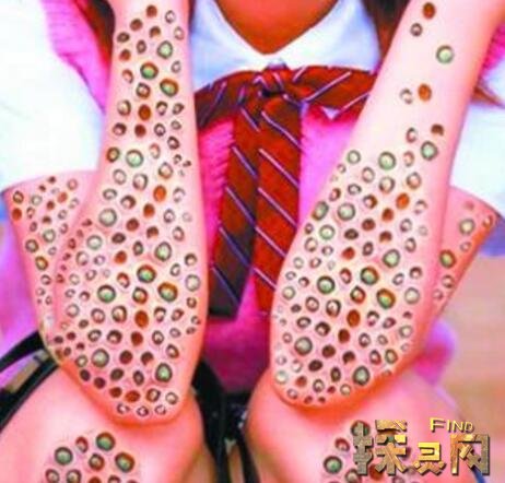 ����������ô���� һ�ֲ�������Ƥ��Ӭ����