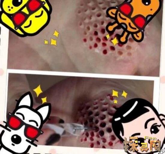 ����������ô���� һ�ֲ�������Ƥ��Ӭ����