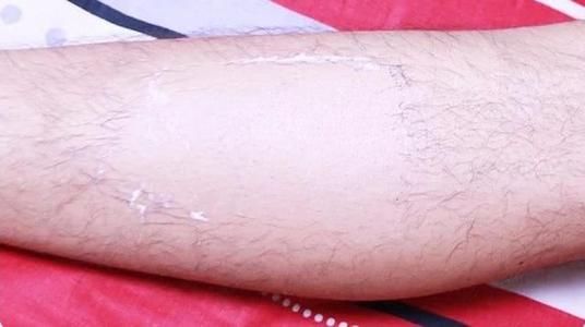 ֥��Ů��ͼƬ�ֲ� ���˺����˻�����Ƥ����