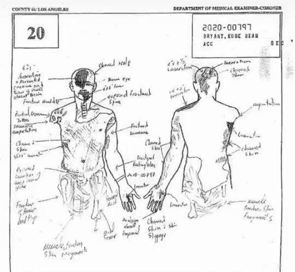 �Ʊȱ��ճ�1��53���� ׹�������Ź�1��98���߱��ճ�1��53