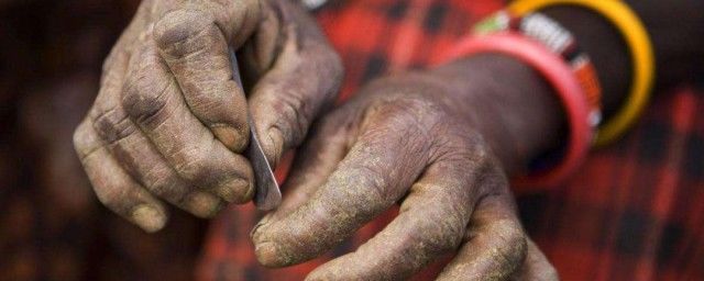 什么是割礼?割哪里?有图片吗 割礼过后的女性是什么样的图片打扑克