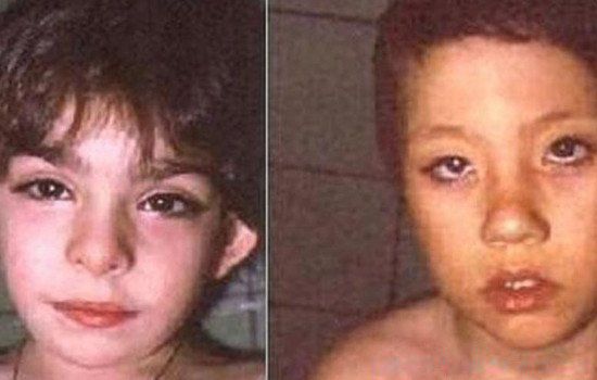 ���輿�ۺ���ʲô��˼ �����ĸ��輿�����ۺ�֢���������Ư����