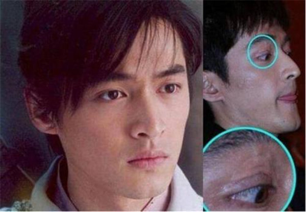 ���賵��ԭ�� �����������������賵�������⻹����Ϊ