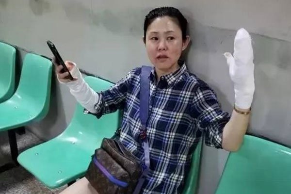 ѩ��������֮��ԡ���� �̲�ԭ�������߹��ɷ�ȴ�޶�����