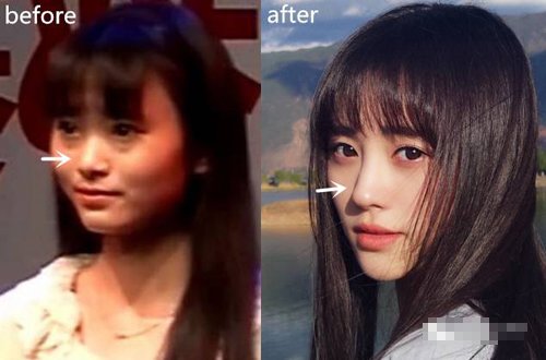 鞠婧祎整容网红前照片 ai智能人脸替换:鞠婧祎以前旧照对比