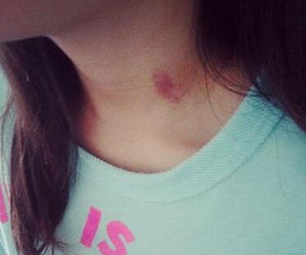 ϲ���ֲ�ݮ��������ʲô���� ���ǵİ������鵽������Կ�