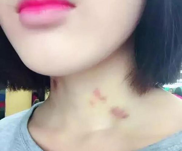 ϲ���ֲ�ݮ��������ʲô���� ���ǵİ������鵽������Կ�