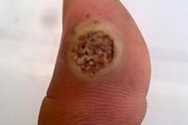 ����ָͼƬ(��СĪ��) �ֲ����ĵĿ���ָ����ô�γɵ�(PS���)