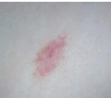 ��������ݮӡ���� ��һ������ݮ����ȷ������λ��