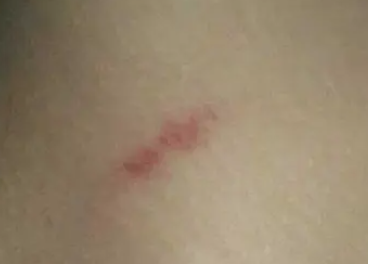 ��������ݮӡ���� ��һ������ݮ����ȷ������λ��