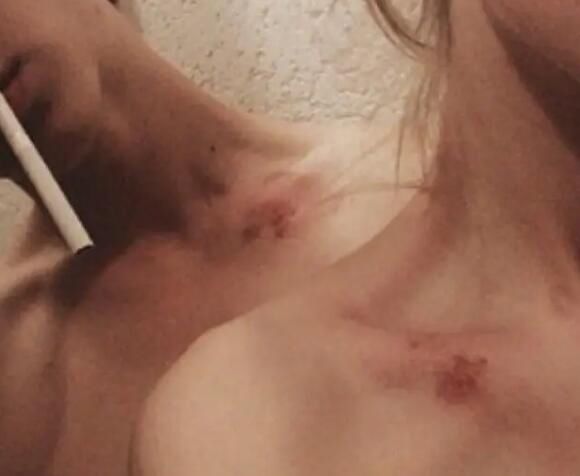 ��������˵Ҫ��С��ݮָʲô ����ݮ�᲻���������