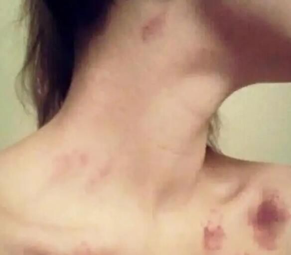 ��������˵Ҫ��С��ݮָʲô ����ݮ�᲻���������