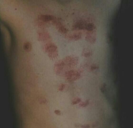 ��������˵Ҫ��С��ݮָʲô ����ݮ�᲻���������