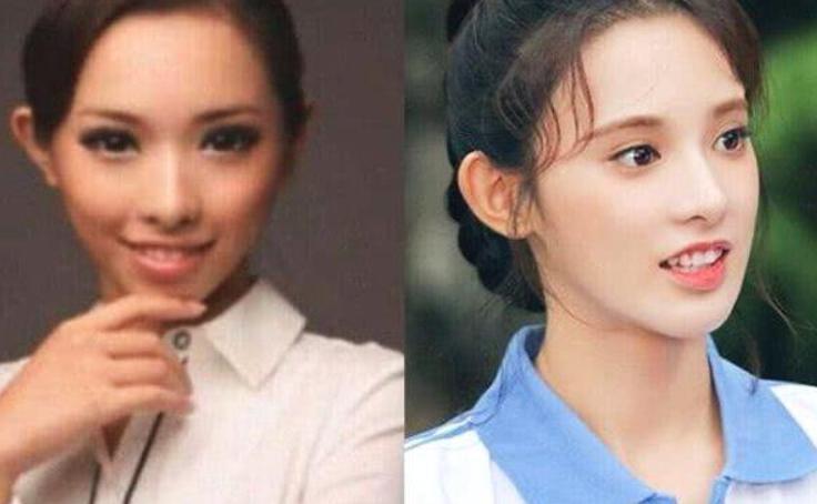 ��С�۽���֢������� ����֮�������ݽ���֢Ů��