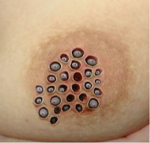 ��������ʲô��˼ ���˾������뼷���Ĳ���