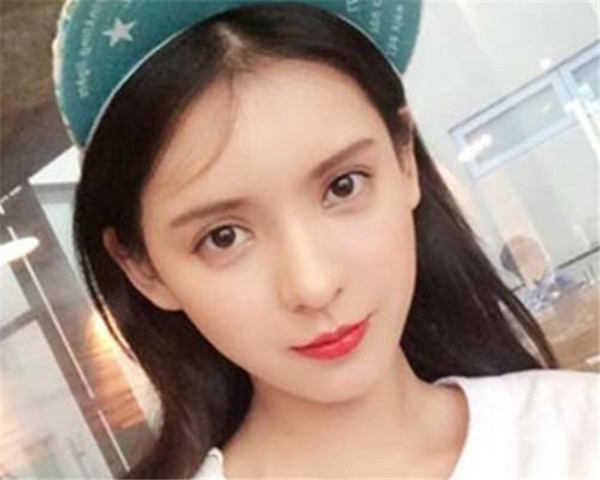 张予曦整容网红前照片对比 瑞丽专属模特张予曦是不是混血