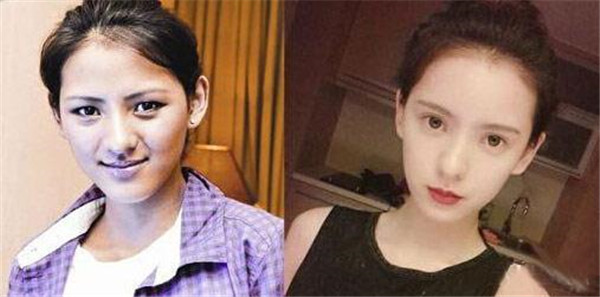 ��������������ǰ��Ƭ�Ա� ����ר��ģ���������ǲ��ǻ�Ѫ