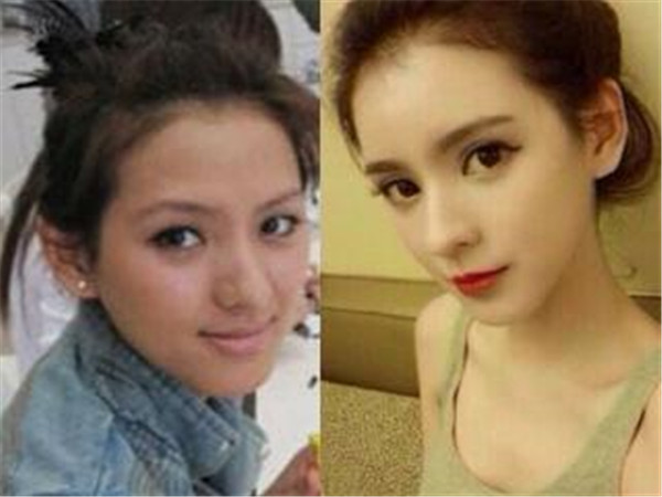 ��������������ǰ��Ƭ�Ա� ����ר��ģ���������ǲ��ǻ�Ѫ