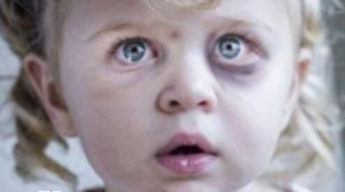 911СŮ���绰¼����� �����¼����ֲ�¼����󻹻�����