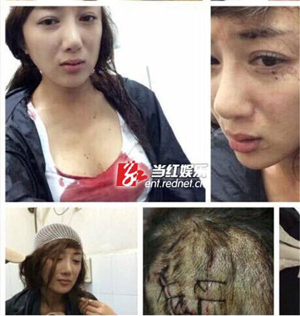 Ҷ��ǲ��Ǿ���̫���� �����½�ͷ��Ҷ诱��¹���ʲô��˼