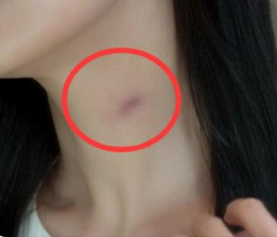 ��ݮӡ��ô�������� �ƿغ����ȣ�����ݮӡ�ļ��ɺ���ȷ��ʽ