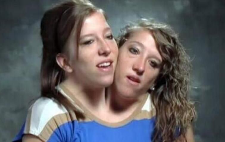 ˫ͷ�˽��û������� �������⣺˫ͷ�˽��õĻ���������״