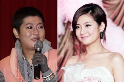 selina�����¼�ǰ��Ա� �ֲ��̺ۣ��ų��к�selinaΪʲô��������