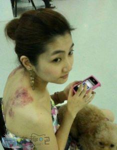 selina�����¼�ǰ��Ա� �ֲ��̺ۣ��ų��к�selinaΪʲô��������