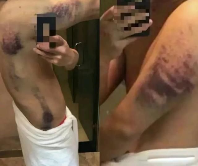 ��鱱��Ϊʲô�й���ȥ���� ʧ�ػ��ң���鱱����������������